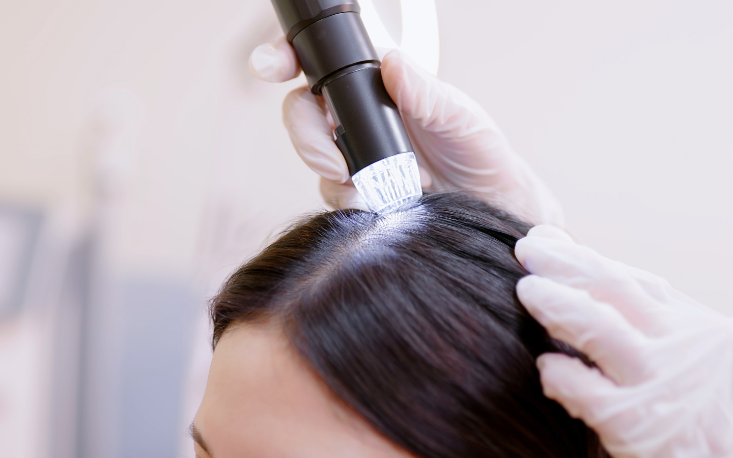 Consultation for hair loss treatment