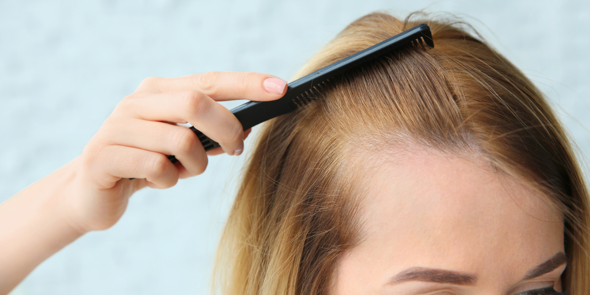 Hair Thinning Treatment Clive Hair